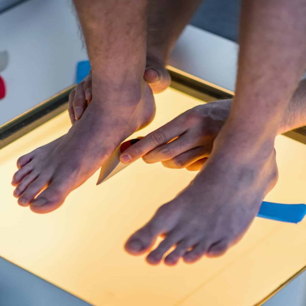 Orthotic prescription process at Pride Podiatry