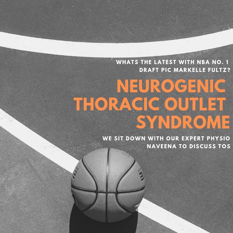 Neurogenic Thoracic Outlet Syndrome