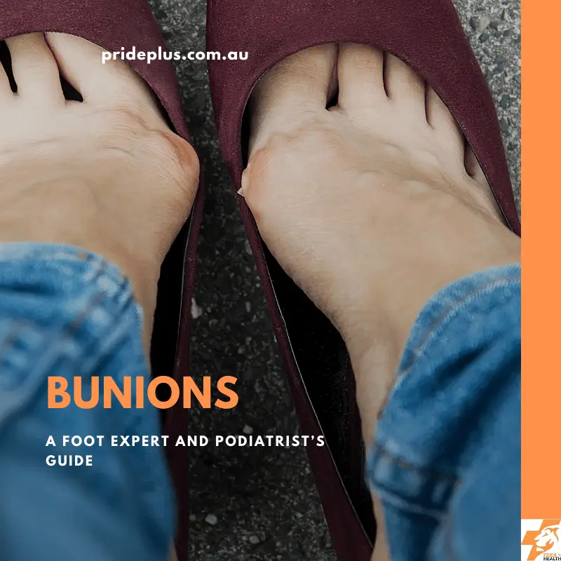 how to treat bunions a foot experts guide