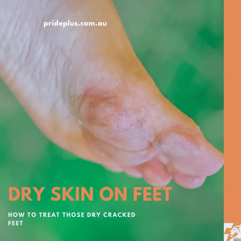 dry skin on feet and text that explains how to fix dry skin on feet