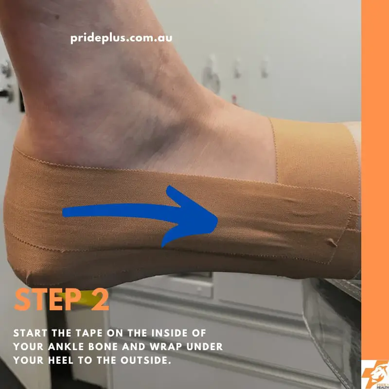 Foot & Ankle Strapping  The Feet People Podiatry