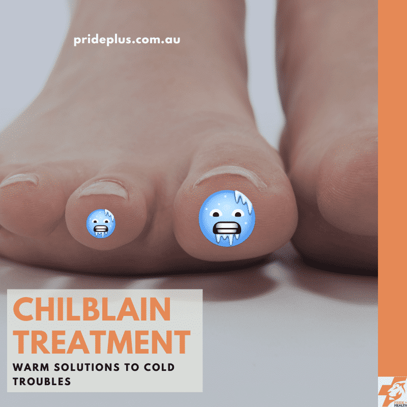 chilblain treatment sore toes in winter and how to fix from podiatrist and foot doctor