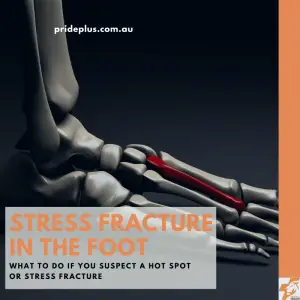 stress fracture in the foot guide of what to do from expert melbourne podiatrist