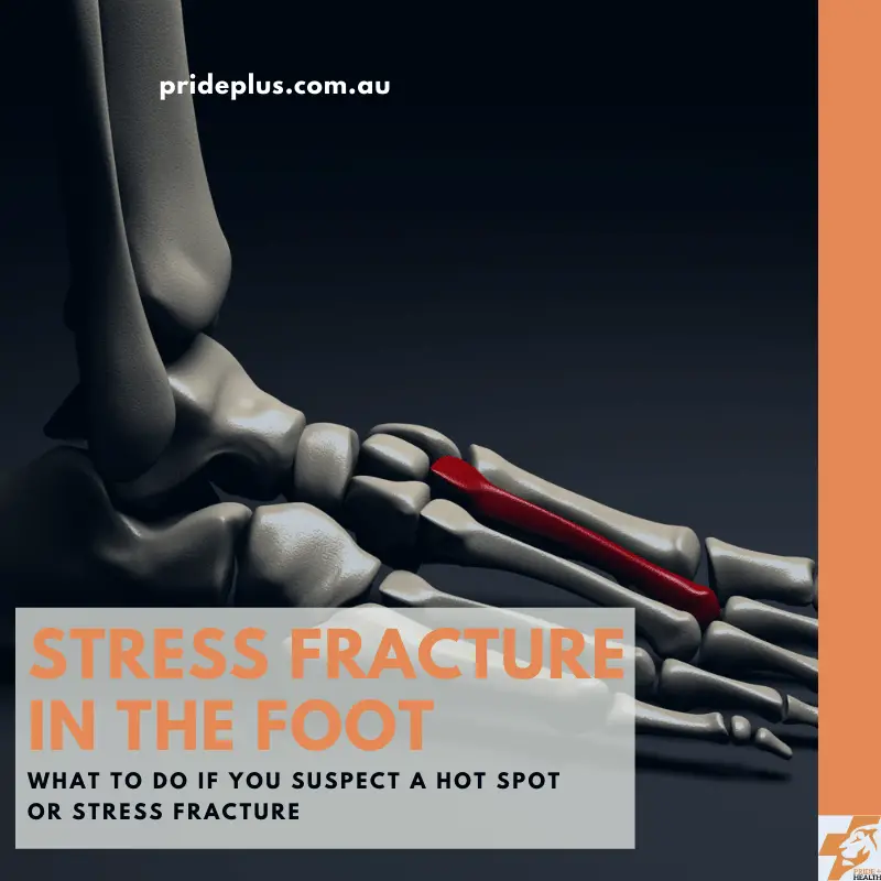 stress fracture in the foot guide of what to do from expert melbourne podiatrist