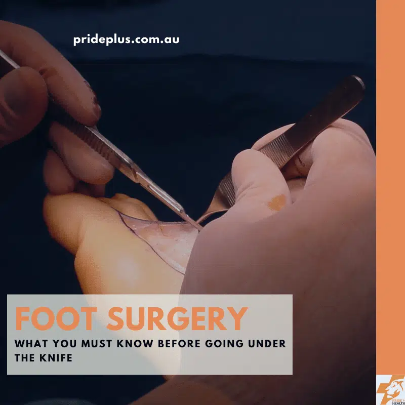 foot surgery or podiatry surgery what you must know before going under the knife