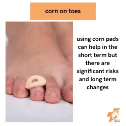 using a corn pad on a corn between toes is not safe according to expert podiatrists