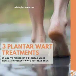 plantar wart treatment options if you get them in the shower or at the swimming pool